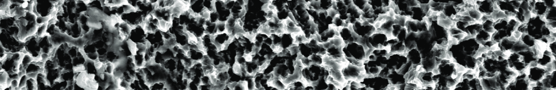 Sand blasting Large grit Acid etching : SLA image